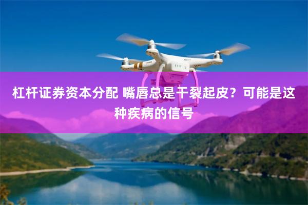 杠杆证券资本分配 嘴唇总是干裂起皮？可能是这种疾病的信号